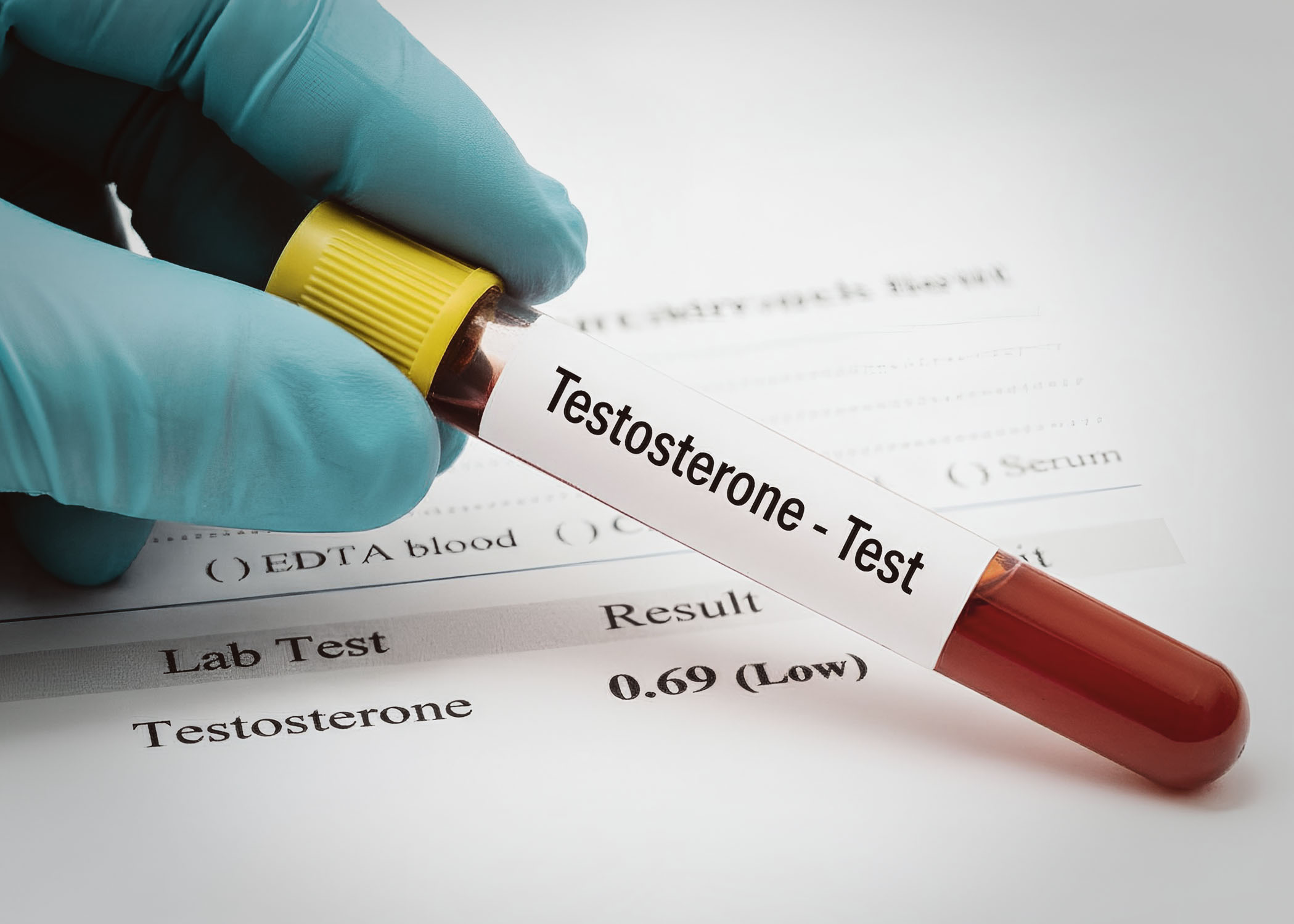 Free vs. Total Testosterone: What Your Blood Test Is Really Telling You
